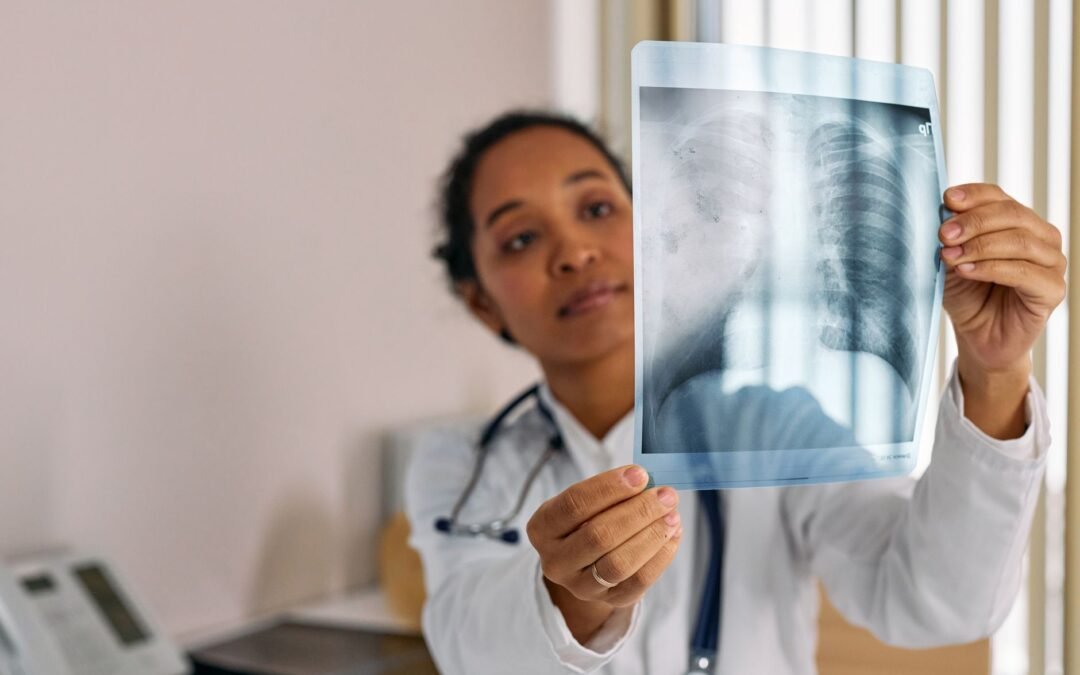 doctor looking at an x ray image of lungs